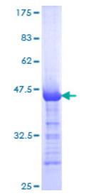 SDS-PAGE (LTBP2-4590H).jpg